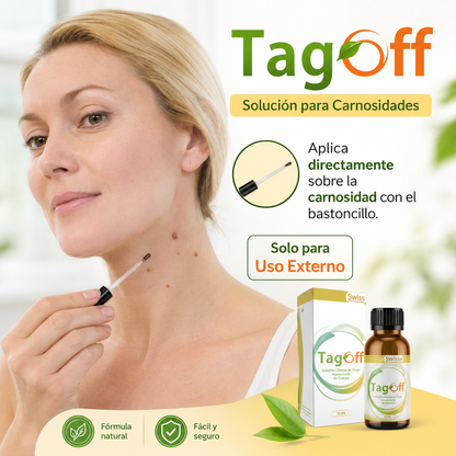 Tag Off Solución para Carnosidades